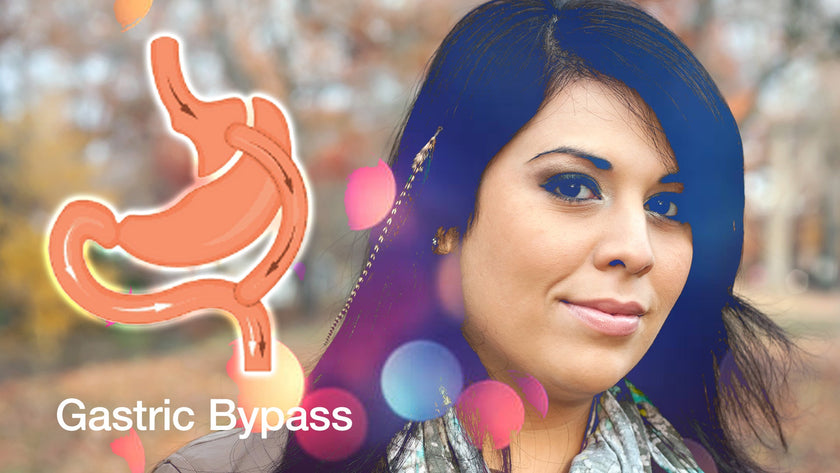 Gastric Bypass Weight Loss